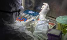 Oxford,  buoni risultati dalla sperimentazione del vaccino sui macachi