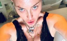 Madonna "mi sottoporro' a un intervento di medicina rigenerativa"
