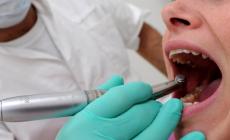 «Quel bacio rubato? È inventato». Fine dell'incubo per un dentista