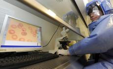 Ebola, caso sospetto a Berlino