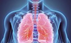 Il 30% dei guariti Covid avrà problemi respiratori cronici