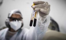 A Parma, nelle ultime 24 ore, nessun morto e 9 nuovi positivi (la maggior parte sono sempre asintomatici) 