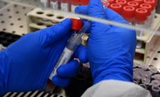 Non ci sono morti a Parma nelle ultime 24 ore, 2 nuovi positivi. 6 decessi in tutta la regione