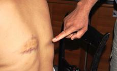 &laquo;La vicina mi ha preso a bastonate&raquo;