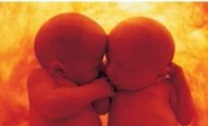 Scambio di embrioni: sono nati i gemelli contesi