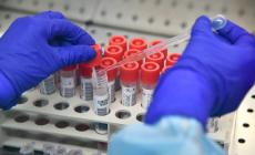  Israele, un farmaco prodotto dagli  anticorpi sembra avere successo