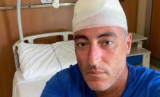 Lavagna, l'assessore Gallera sbatte la testa, 30 punti di sutura