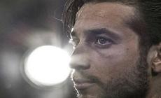Roma: il portiere Mirante (ex Parma) positivo al Covid-19