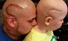  E' morto Gabe: il papà si tatuò in testa una cicatrice uguale alla sua