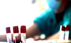 Parma, 11 nuovi casi. 127  in regione (nessun decesso)