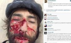 Brumotti, a bombazza con la faccia