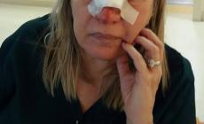 Donna accusa: "Picchiata da un taxista". E mostra la foto