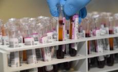 12 nuovi contagi a Parma: 4 dall'estero, 3 focolai familiari