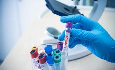 Ausl e Ospedale: «Pronti per la seconda ondata di contagi»