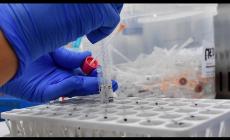 Diminuiscono ancora i contagi in Italia, sono 22.253 (con meno tamponi: 135.731). 233 decessi