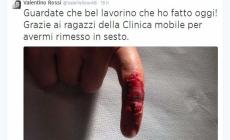 Rossi mostra il dito malconcio