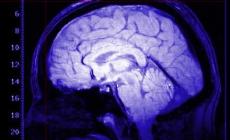 Giornata nazionale Parkinson: tre giorni di iniziative in città e provincia organizzate dalle Aziende sanitarie