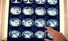 Tumore del Pancreas: conosci i campanelli d&rsquo;allarme?