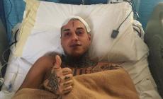 "Temptation Island", operazione riuscita per Francesco Chiofalo: "Ce l?ho fatta, sto bene"