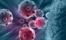 La prima terapia anti tumore con cellule del paziente arriva in Europa