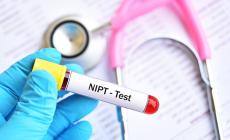 Il test del sangue gratuito per valutare la salute del feto