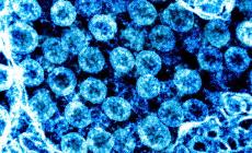 &nbsp;La luce solare 'uccide'&nbsp;il virus Sars-Cov-2  in pochi minuti