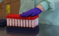 Con 27 nuovi casi Parma &egrave; seconda in Emilia Romagna per contagi, ma nessun decesso. Stabile il numero dei pazienti in terapia intensiva (5)