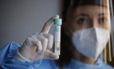 Covid, 1.612 nuovi casi e 37 decessi nelle ultime 24 ore in Italia