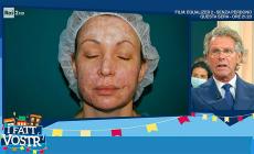 La modella sfigurata  che ha ritrovato se stessa 