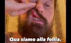 Facchinetti, 'io aggredito senza ragione da McGregor'