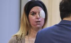 Violenza sulle donne: iniziative e testimonianze per dire "no". Gessica Notaro all'Eurosia