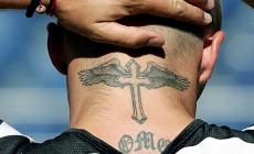 Rimozione tatuaggi: nuova denuncia contro 'skinial' 