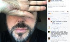Omofobia, Shalpy: "Sputi e insulti per strada: un trauma"