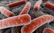 Langhirano,  segnalato un caso di tubercolosi