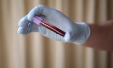 Leucemie pediatriche, ecco quali sintomi devono farci preoccupare