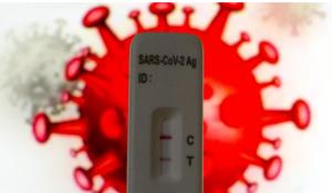 Tutte le province della regione sotto i 100 nuovi contagi nelle ultime 24 ore: 66 a Parma. Nessun decesso nella notra provincia