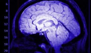 Giornata nazionale Parkinson: tre giorni di iniziative in città e provincia organizzate dalle Aziende sanitarie