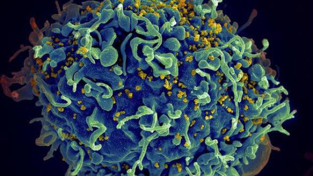 L'Hiv accelera l'invecchiamento del corpo di quasi 5 anni