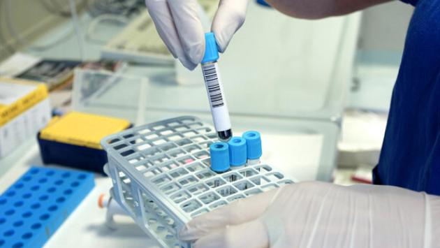 Allerta Ecdc per epatite A, focolaio con 303 casi in 7 Paesi