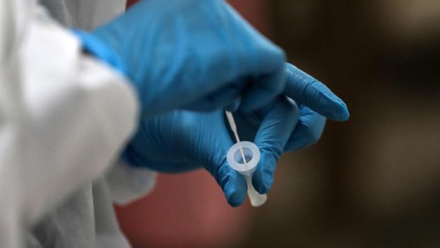 test covid coronavirus