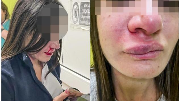 Infermiera trascinata per i capelli e colpita con pugno in viso