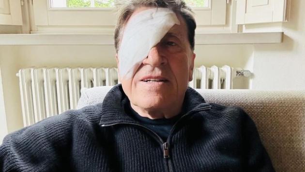 Gianni Morandi bendato su social scherza, 'ho fatto a pugni' 