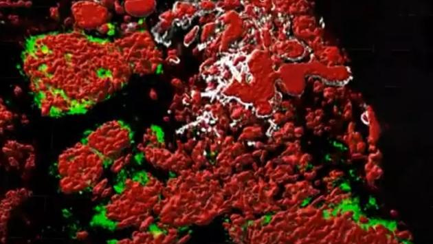 Pronto l'atlante 3D dei tumori, base per nuove terapie