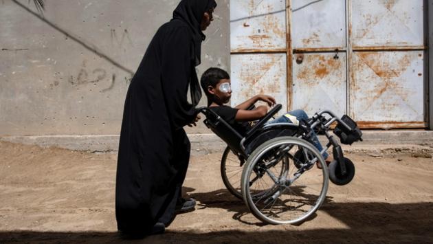Onu, almeno 21.000 bimbi a Gaza disabili a causa guerra
