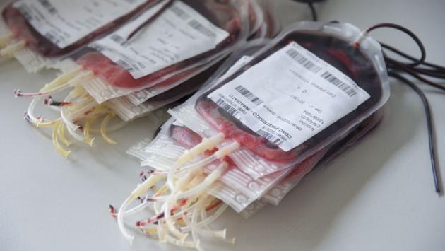 Nas, chiusi 52 centri: sangue manipolato per estetica 