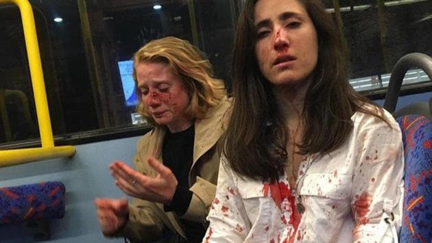 Lesbiche rifiutano di baciarsi sul bus, picchiate da omofobi