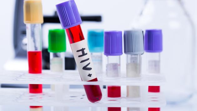 Nasconde di essere malato di Hiv e contagia quattro donne, muore la sua ex compagna