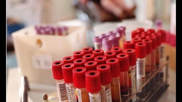 Sei immune al Covid? Un nuovo test rapido lo misurerà in meno di 24 ore
