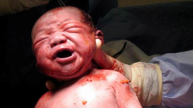 L'ecografia in sala parto, un aiuto per mamme e bimbi