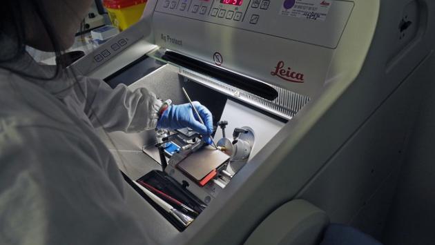 Trapianto renale, a Parma un nuovo strumento di  ricerca e diagnosi